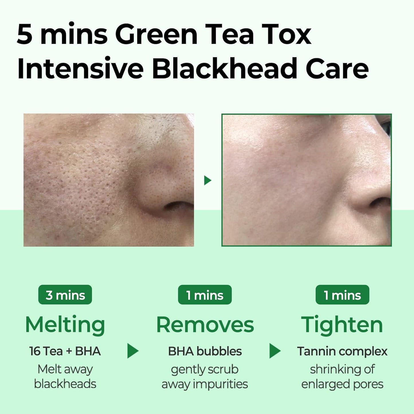 [SomeByMi] BYE ​​BY BLACKHEAD 30 DAYS MIRACLE GREEN TEA TOX BUBBLE CLEANSER 120 г