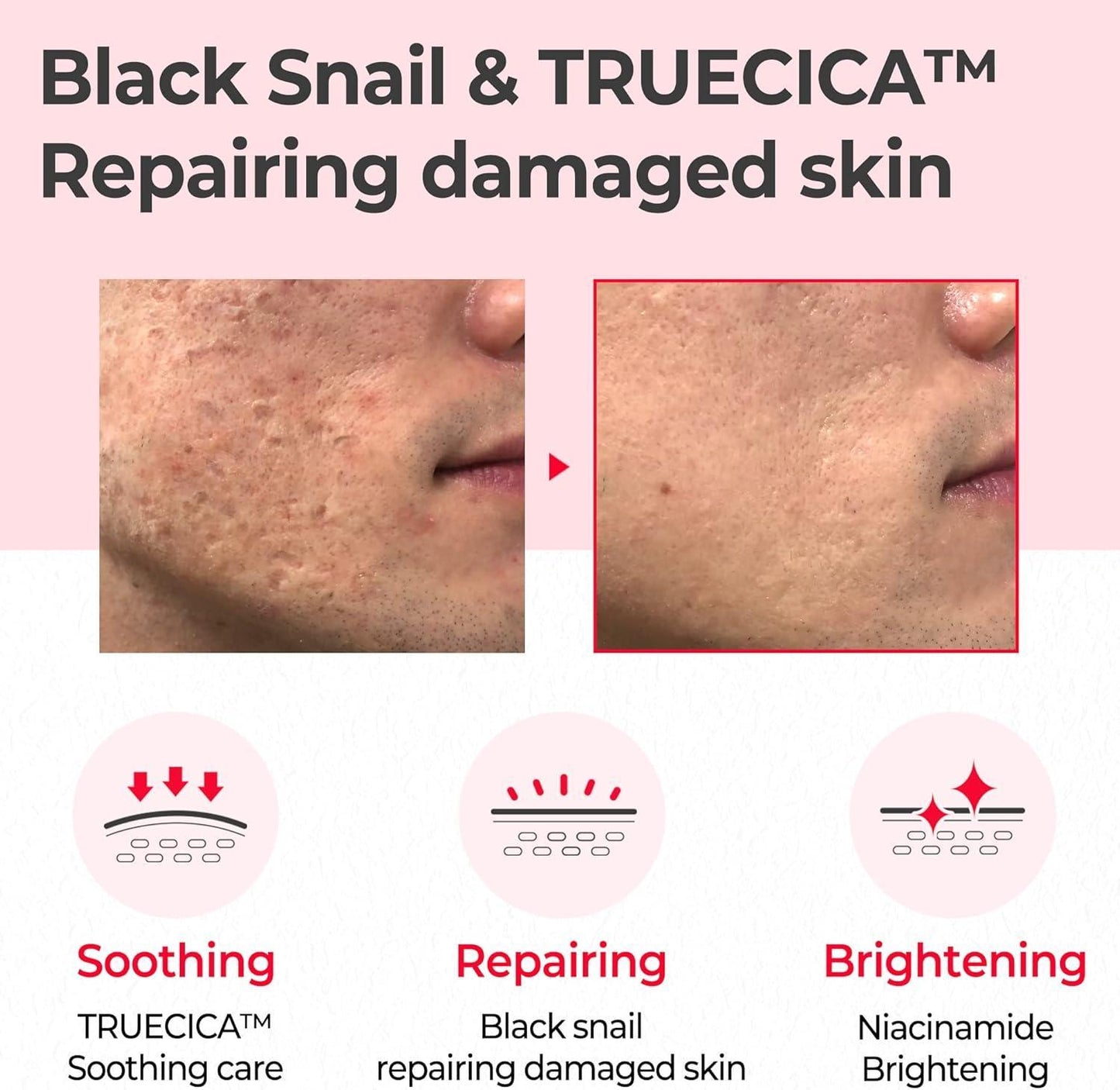 [SomeByMi] ТОНИК ДЛЯ ВОССТАНОВЛЕНИЯ SNAIL TRUECICA MIRACLE 150 мл