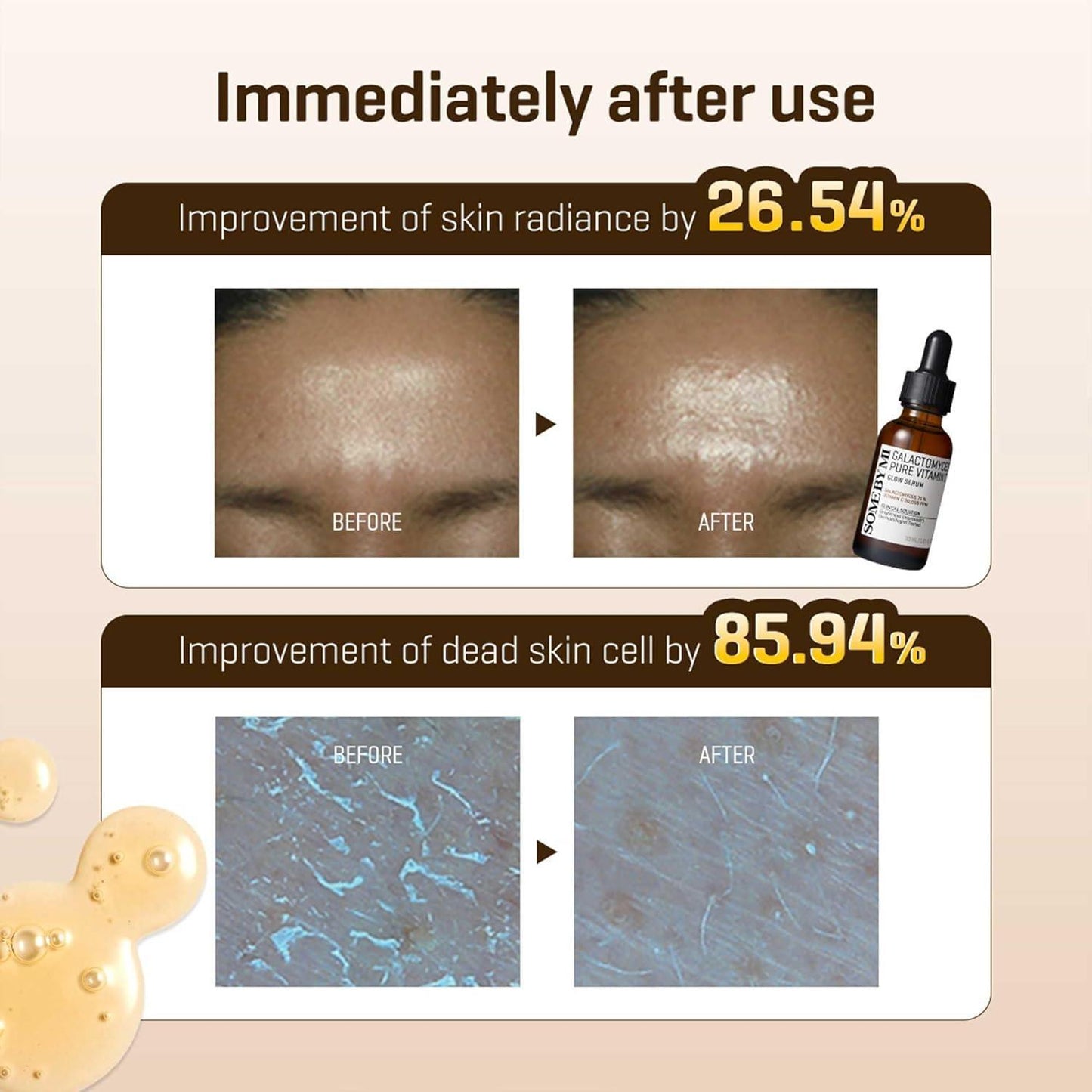 [SomeByMi] GALACTOMYCES PURE VITAMIN C GLOW SERUM 30 мл