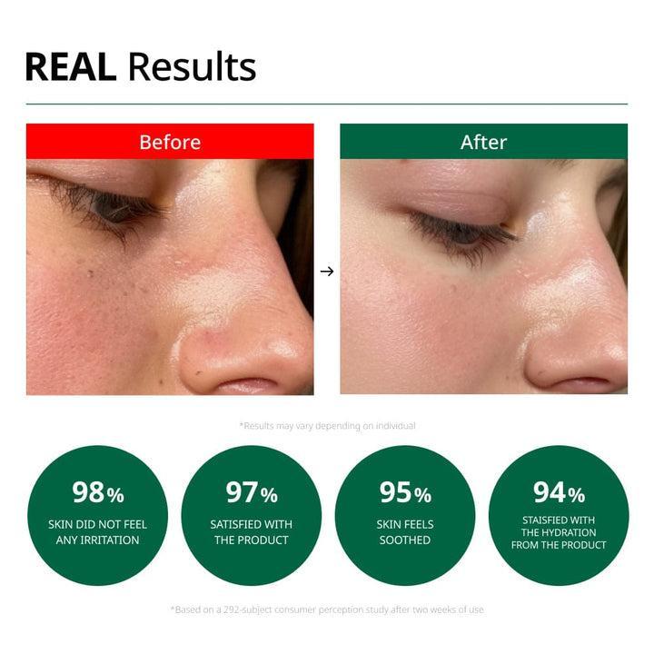 [Dr.G] Успокаивающий крем для проблемной кожи Red Blemish Clear 70 мл