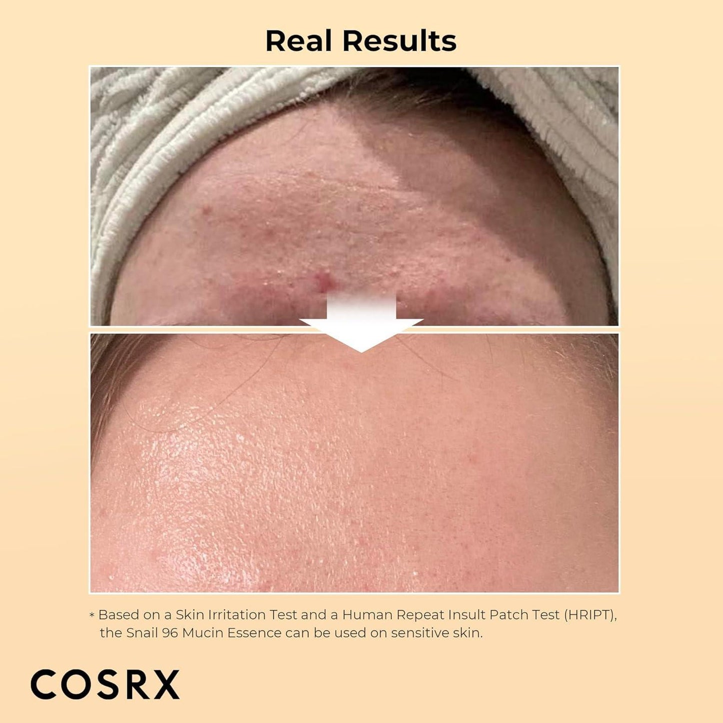 [Cosrx] Advanced Snail 96 Mucin Power Essence 100 мл