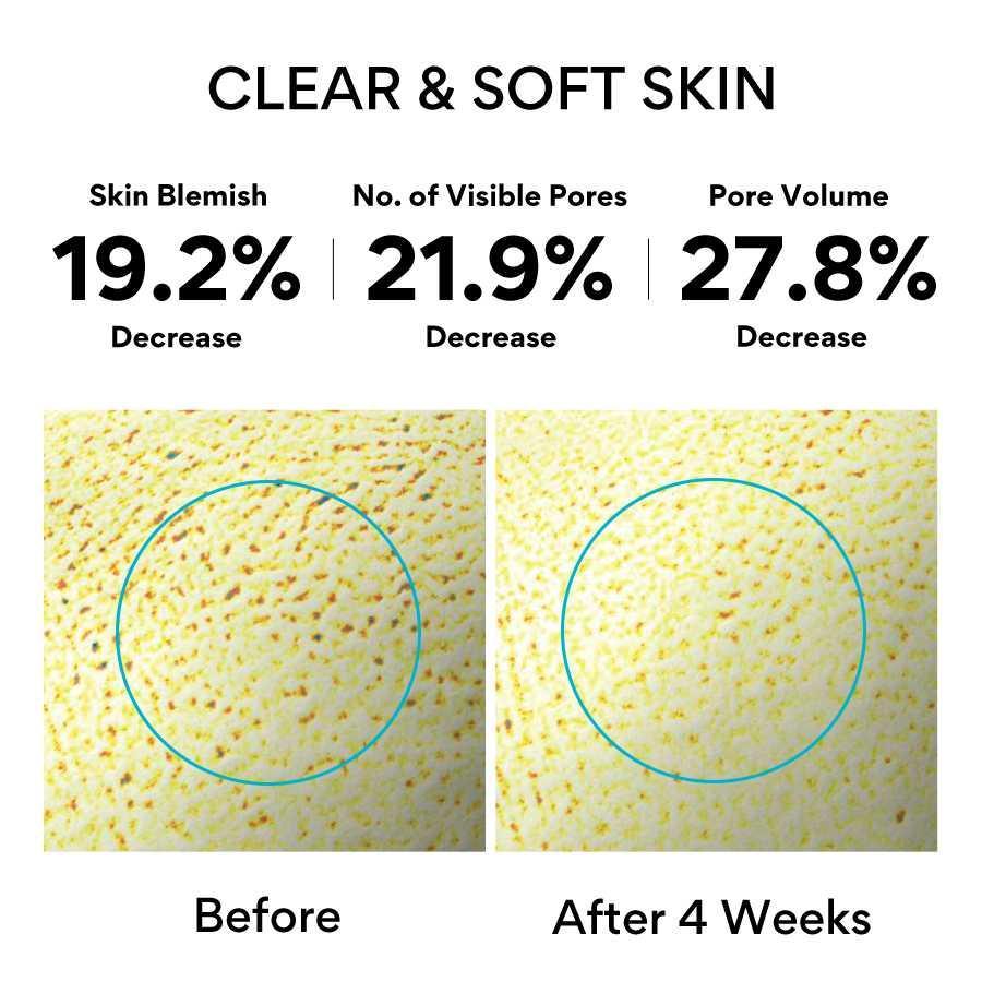 [Innisfree] Ампула Retinol Cica Repair 30 мл